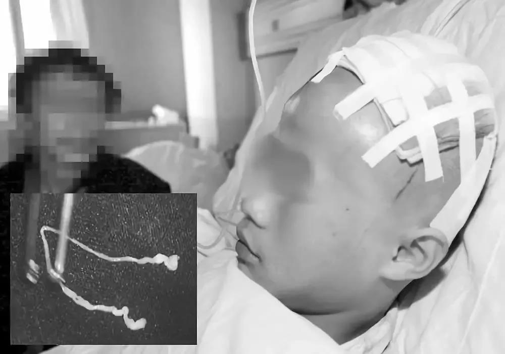 青蛙好吃,却毁了一个家庭!